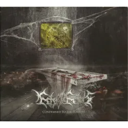 Feto in Fetus- Condemned to the Torture